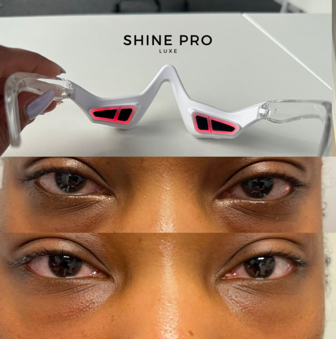 Shine Pro Eye Revive | Red Light & Microcurrent Technology