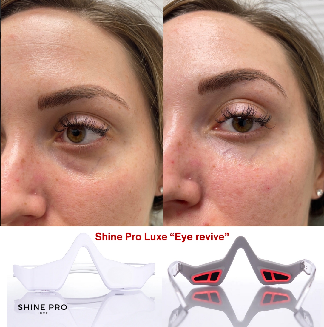 Shine Pro Eye Revive | Red Light & Microcurrent Technology